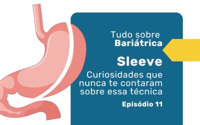 Tudo sobre o Sleeve gástrico: curiosidades, dicas e truques