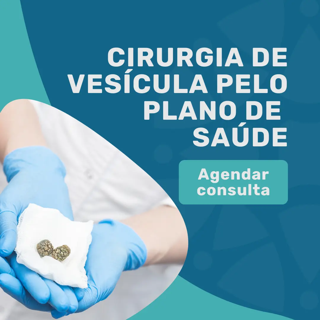 Faça a sua Cirurgia de Vesícula pelo Mediservice