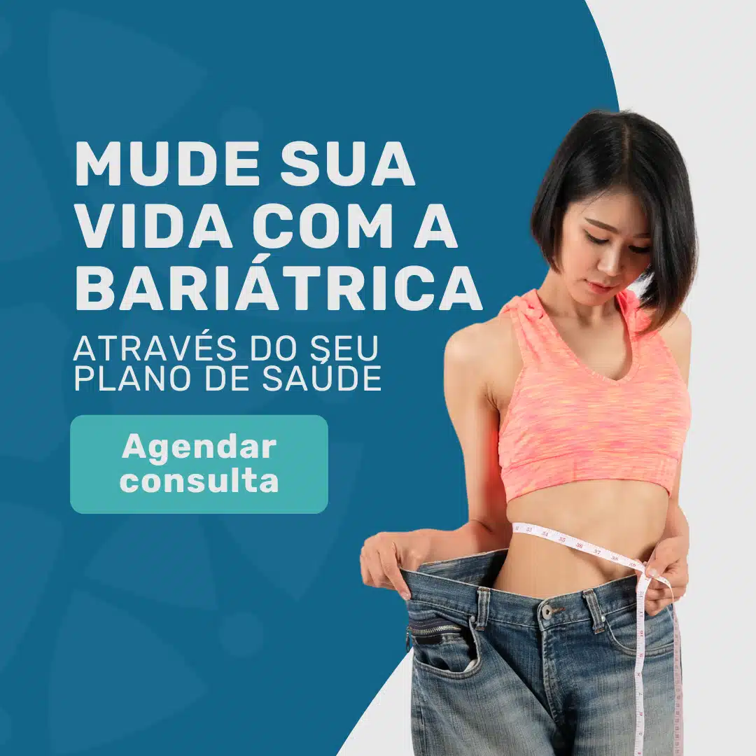 Bariátrica pelo plano Omint Skill